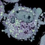 Cancer en Afrique