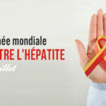 hepatite